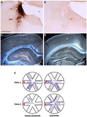 Noradrenergic Hypothesis Linking Neurodegeneration-Based Cognitive Decline and Astroglia